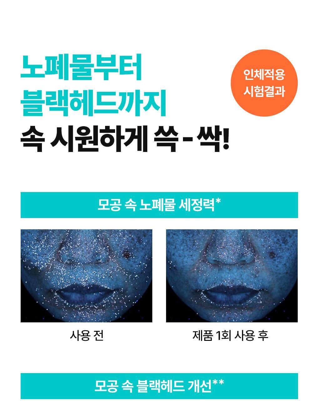 MEDIHEAL Mogongtox(pore detox) Wash-off Soda Bubble Sheet